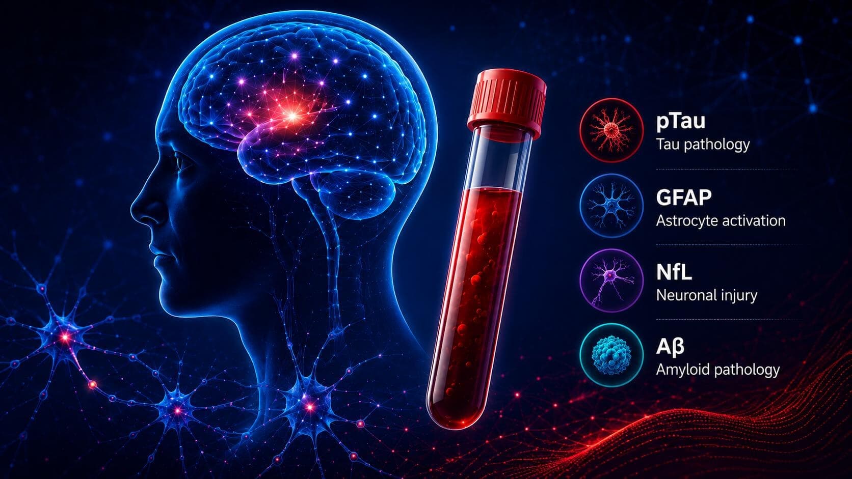 A Blood Biomarker May Reveal Early Alzheimer’s-Related Changes in Adults With Down Syndrome