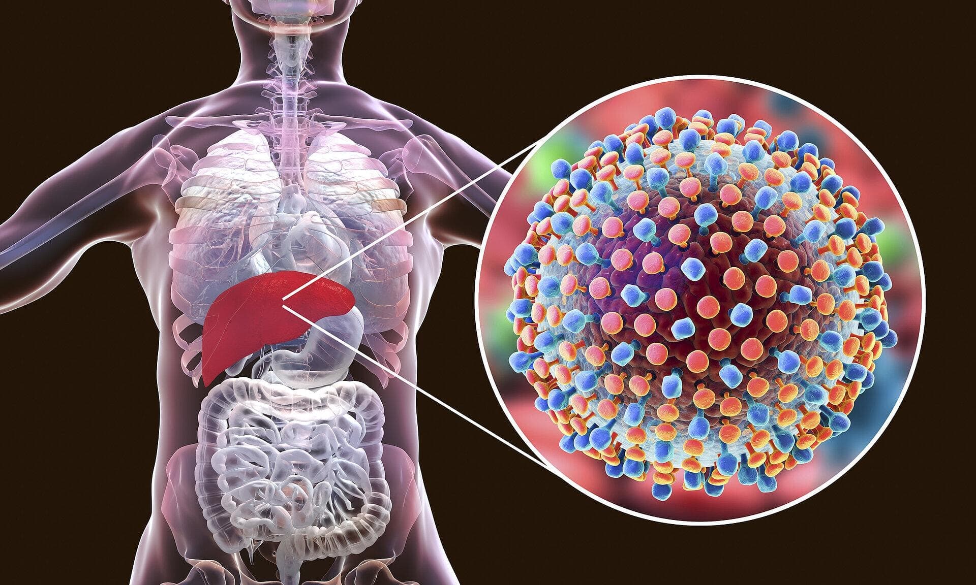 Indian Clinical Trial Finds Eight-Week Hepatitis C Treatment Comparable to the Standard 12 Weeks